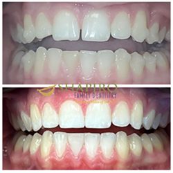 Cigna Dental Insurance Cigna Dental Insurance
