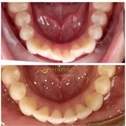 Cigna Dental Insurance Cigna Dental Insurance