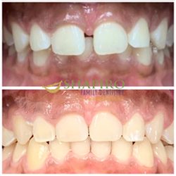Cigna Dental Insurance Cigna Dental Insurance
