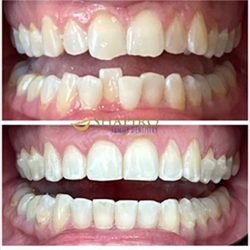 Cigna Dental Insurance Cigna Dental Insurance