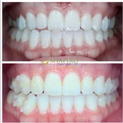 Cigna Dental Insurance Cigna Dental Insurance