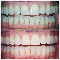 Cigna Dental Insurance Cigna Dental Insurance