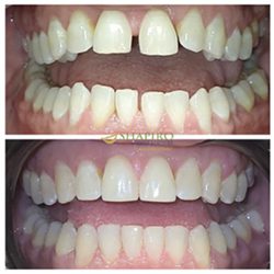Cigna Dental Insurance Cigna Dental Insurance