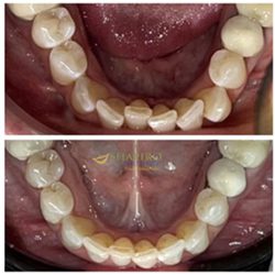 Cigna Dental Insurance Cigna Dental Insurance