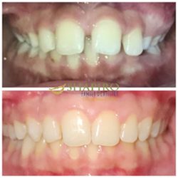 Cigna Dental Insurance Cigna Dental Insurance