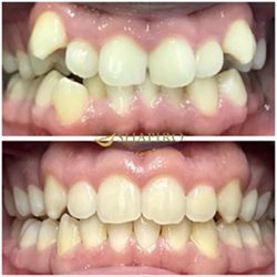 Cigna Dental Insurance Cigna Dental Insurance