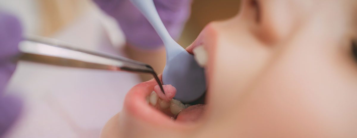annual dental visits