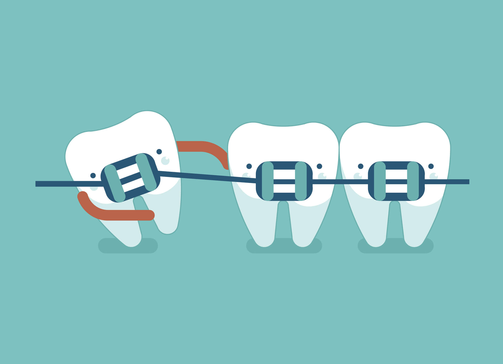 Do I need braces Boca Raton?
