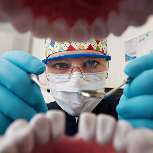 dental implants