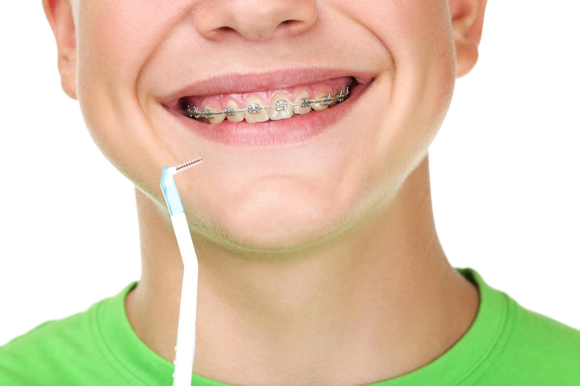 braces west palm beach