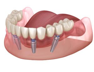 beautiful teeth and smile and importance for attractiveness