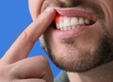 periodontal disease causes