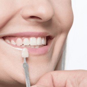 crowns vs veneers